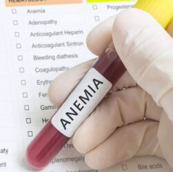 Tips for Dealing with Anemia